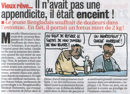 Article sur un bengladais qui avait un foetus mort de 2kg dans son estomac